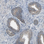 Immunohistochemical staining of human prostate shows moderate cytoplasmic positivity in glandular cells.