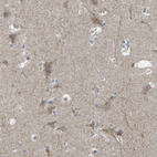 Immunohistochemical staining of human cerebral cortex shows moderate cytoplasmic/cytoplasmic granular positivity in neurons and neuropil.