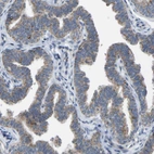 Immunohistochemical staining of human fallopian tube shows weak cytoplasmic positivity in glandular cells.