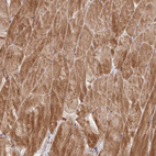 Immunohistochemical staining of human skeletal muscle shows strong cytoplasmic positivity in myocytes.