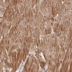 Immunohistochemical staining of human skeletal muscle shows strong cytoplasmic positivity in myocytes.