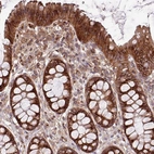 Immunohistochemical staining of human gastrointestinal shows strong cytoplasmic positivity in glandular cells.