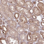 Immunohistochemical staining of human kidney shows moderate cytoplasmic positivity in cells in tubules.
