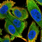 Immunofluorescent staining of human cell line PC-3 shows localization to cytosol.