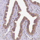Immunohistochemical staining of human fallopian tube shows moderate cytoplasmic positivity in glandular cells.