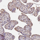 Immunohistochemical staining of human placenta shows moderate cytoplasmic positivity in trophoblastic cells and endothelial cells.