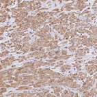 Immunohistochemical staining of human prostate shows moderate cytoplasmic positivity in smooth muscle cells.