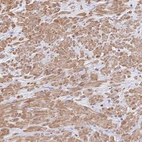 Immunohistochemical staining of human prostate shows moderate cytoplasmic positivity in smooth muscle cells.
