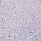 Immunohistochemical staining of human cerebral cortex shows no positivity in neurons.