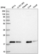 Western blot analysis in human cell line RT-4, human cell line U-251 MG, human plasma, human liver tissue and human tonsil tissue.