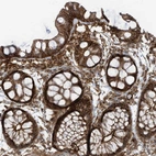 Immunohistochemical staining of human colon shows strong membranous/cytoplasmic membranous positivity in glandular cells and lymphoid cells.