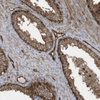 Immunohistochemical staining of human prostate shows strong membranous positivity in glandular cells.