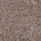 Immunohistochemical staining of human pancreas shows moderate membranous/cytoplasmic membranous positivity in exocrine glandular cells.