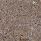 Immunohistochemical staining of human pancreas shows moderate membranous/cytoplasmic membranous positivity in exocrine glandular cells.