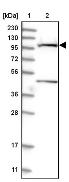Lane 1: Marker [kDa] 230, 130, 95, 72, 56, 36, 28, 17, 11_br/_Lane 2: Human cell line RT-4
