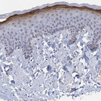 Immunohistochemical staining of human skin shows strong cytoplasmic positivity in keratinocytes.