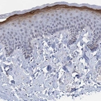 Immunohistochemical staining of human skin shows strong cytoplasmic positivity in keratinocytes.