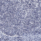 Immunohistochemical staining of human tonsil tissue shows no in non-germinal center cells as expected.