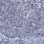 Immunohistochemical staining of human tonsil tissue shows no in non-germinal center cells as expected.