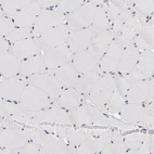 Immunohistochemical staining of human skeletal muscle shows no positivity in myocytes as expected.