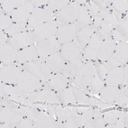 Immunohistochemical staining of human skeletal muscle shows no positivity in myocytes as expected.