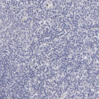 Immunohistochemical staining of human tonsil tissue shows no positivity in non-germinal center cells as expected.