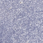 Immunohistochemical staining of human tonsil tissue shows no positivity in non-germinal center cells as expected.