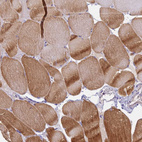 Immunohistochemical staining of human skeletal muscle shows moderate cytoplasmic positivity in myocytes.