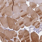 Immunohistochemical staining of human skeletal muscle shows moderate cytoplasmic positivity in myocytes.