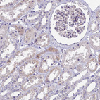 Immunohistochemical staining of human kidney shows weak cytoplasmic positivity in cells in tubules.