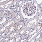 Immunohistochemical staining of human kidney shows weak cytoplasmic positivity in cells in tubules.