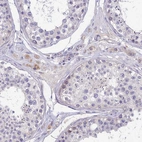 Immunohistochemical staining of human testis shows weak to moderate cytoplasmic positivity in Leydig cells.