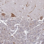 Immunohistochemical staining of human cerebellum shows moderate cytoplasmic positivity in Purkinje cells.