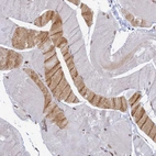 Immunohistochemical staining of human skeletal muscle shows moderate cytoplasmic and nuclear positivity in subset of myocytes.