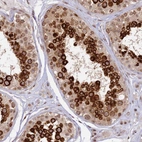 Immunohistochemical staining of human testis shows strong cytoplasmic and nuclear/nuclear membranous positivity in cells in seminiferous ducts.