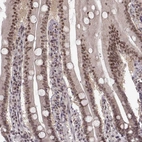 Immunohistochemical staining of human gastrointestinal shows moderate nuclear positivity in glandular cells.
