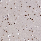 Immunohistochemical staining of human cerebral cortex shows strong nuclear positivity in neurons.