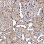 Immunohistochemical staining of human kidney shows moderate nuclear positivity in cells in tubules.