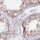 Immunohistochemical staining of human testis shows strong nuclear positivity in cells in seminiferous ducts.