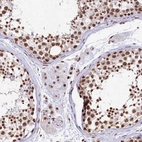 Immunohistochemical staining of human testis shows strong nuclear positivity in cells in seminiferous ducts.