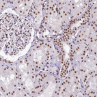 Immunohistochemical staining of human kidney shows moderate nuclear positivity in cells in tubules.