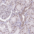 Immunohistochemical staining of human kidney shows moderate nuclear positivity in cells in tubules.