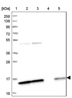 Lane 1: Marker [kDa] 250, 130, 95, 72, 55, 36, 28, 17, 10_br/_Lane 2: Human cell line RT-4_br/_Lane 3: Human cell line U-251MG sp_br/_Lane 4: Human plasma (IgG/HSA depleted)_br/_Lane 5: Human liver tissue