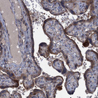 Immunohistochemical staining of human placenta shows moderate cytoplasmic and membranous positivity in trophoblastic cells.