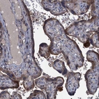 Immunohistochemical staining of human placenta shows moderate cytoplasmic and membranous positivity in trophoblastic cells.
