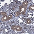 Immunohistochemical staining of human salivary gland shows moderate cytoplasmic positivity in ductal cells.