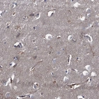 Immunohistochemical staining of human cerebral cortex shows weak positivity in neuropil.