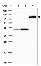 Lane 1: Marker [kDa] 250, 130, 95, 72, 55, 36, 28, 17, 10_br/_Lane 2: Human cell line RT-4_br/_Lane 3: Human cell line U-251MG sp_br/_Lane 4: Human plasma (IgG/HSA depleted)