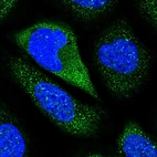 Immunofluorescent staining of human cell line U-2 OS shows localization to cytosol.