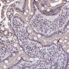Immunohistochemical staining of human duodenum shows moderate nuclear positivity in subset of glandular cells.